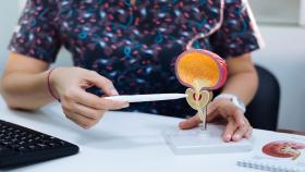 Photo of doctor using a plastic model of a prostate to show the anatomy of the prostate.