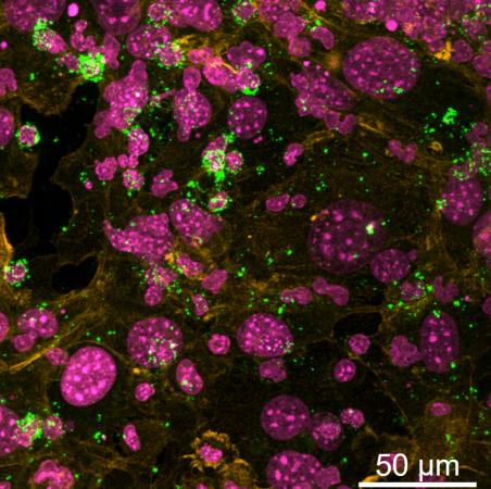 Confocal microscopy image of primary, mature B cells with support stromal cells in synthetic immune organoids cultured in a tissue culture dish. Upon activation, B cells express the green protein GL7.