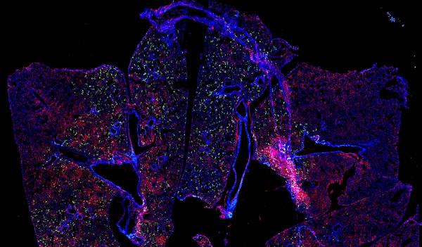 Stitched confocal microscopy image of RSV-infected mouse lung. RSV nucleoprotein and fusion proteins appear red and green, respectively. Cell nuclei appear blue.