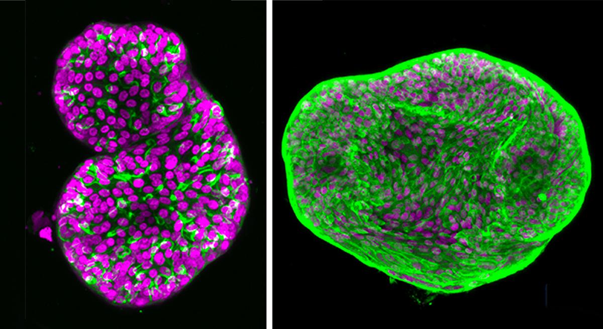 Organoids